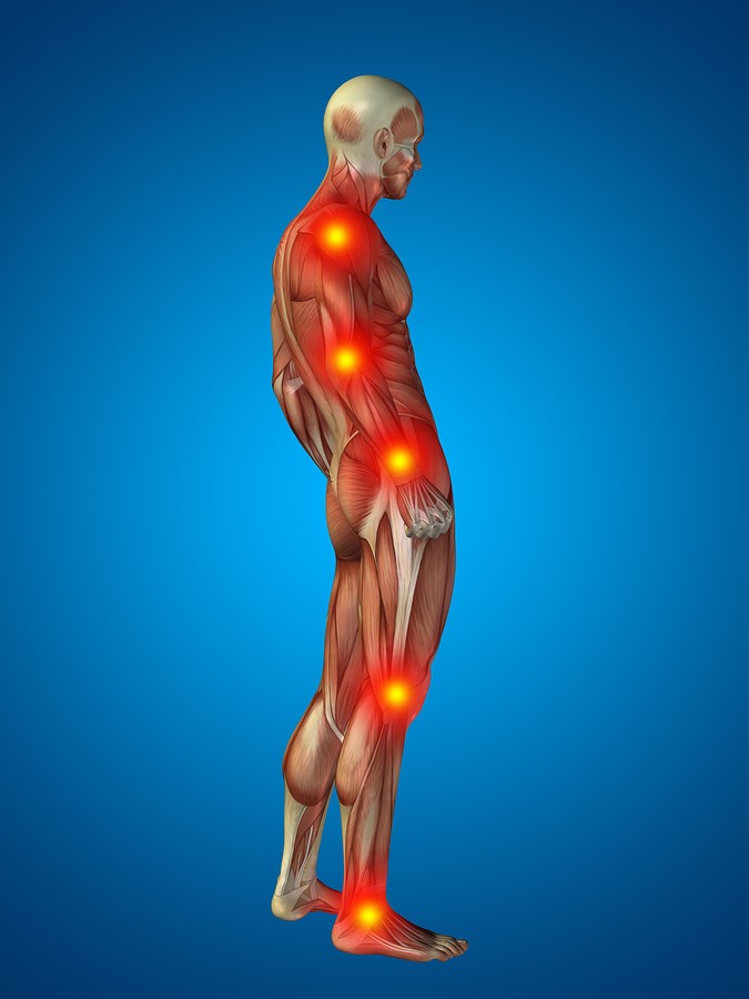 Muscles Pain Treatment in Calgary